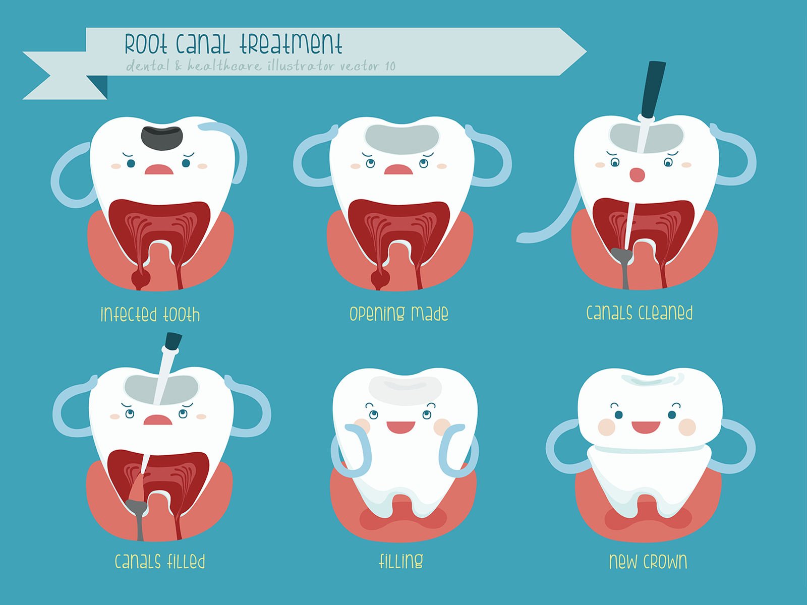 Can Root Canal Heal Itself?