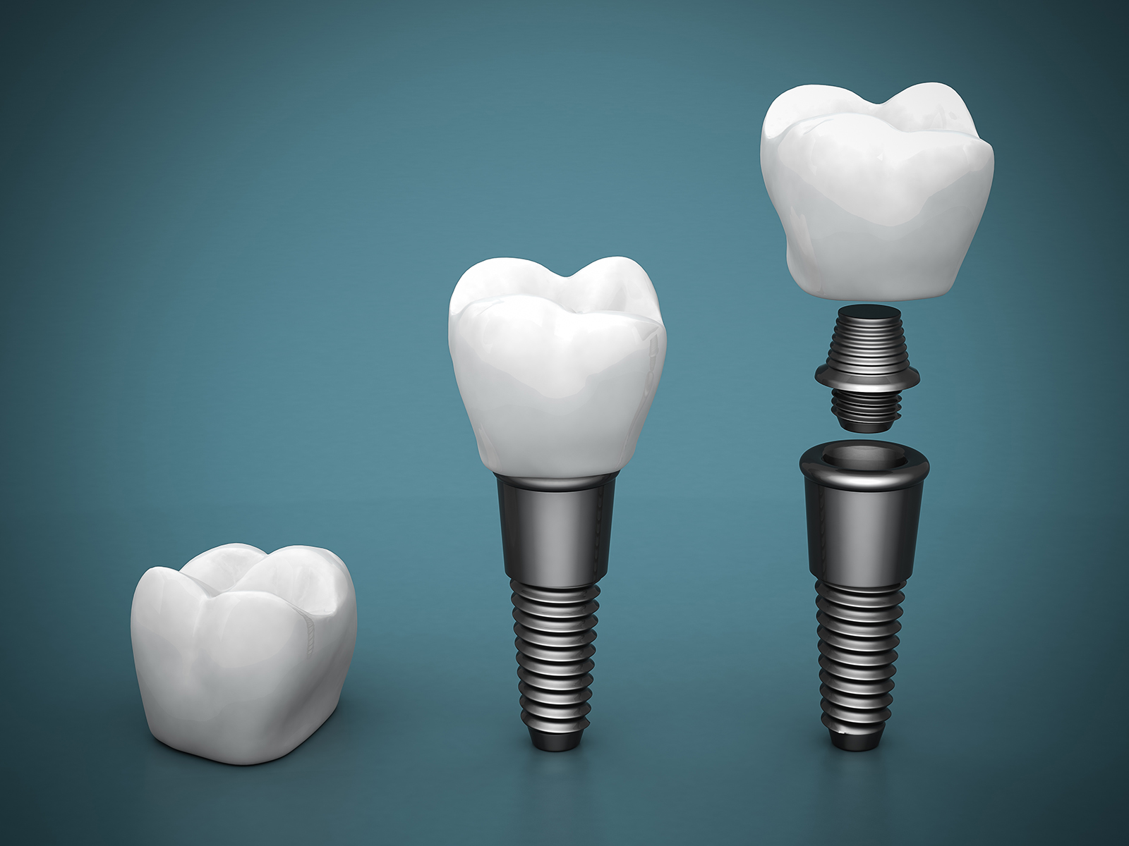 What can you eat after an abutment surgery?