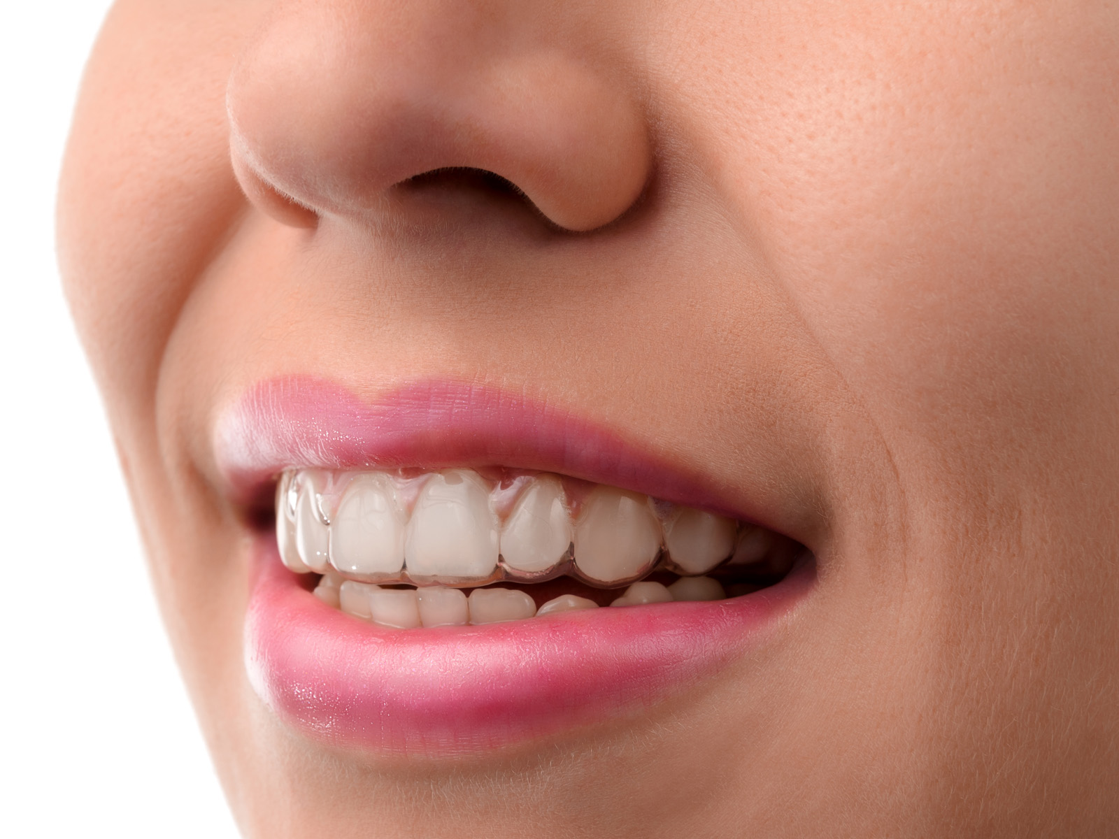 Does Invisalign make your breath smell?