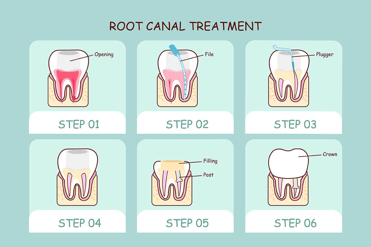 Benbrook TX Dental Office