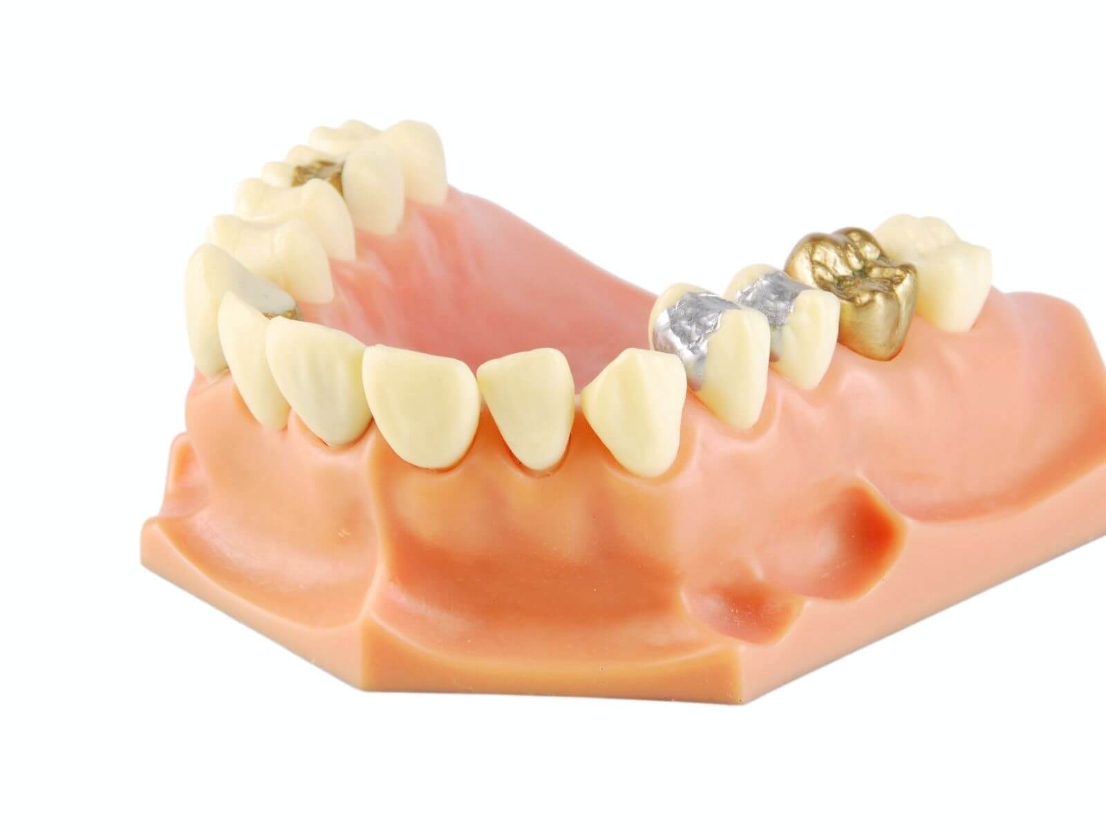 Signs Your Dental Filling Needs To Be Replaced