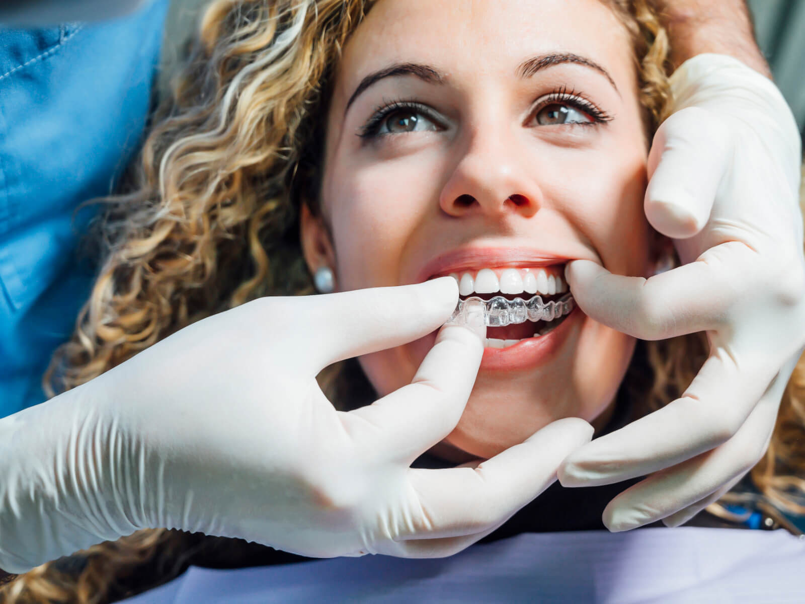 Will I Need Rubber Bands As Part of My Invisalign Treatment?