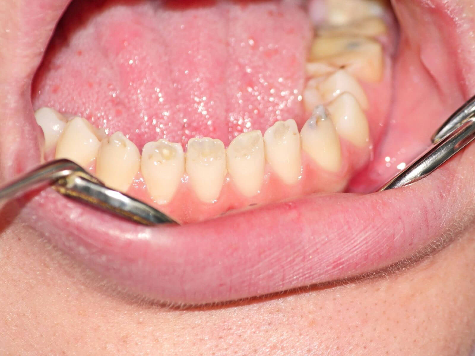The Connection Between Gut Health and Dental Health