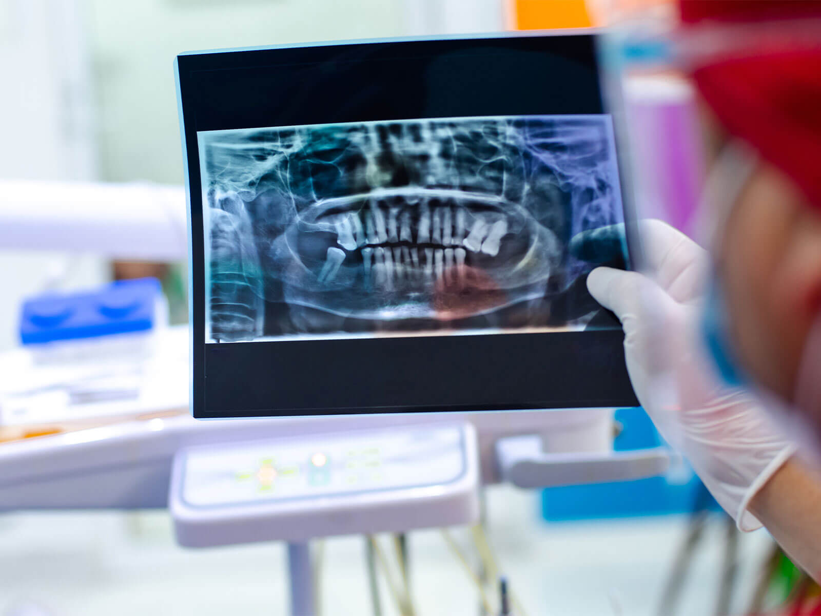 Types of Dental X-Rays